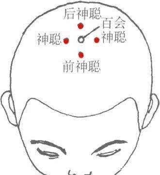 四神聪的功效与作用