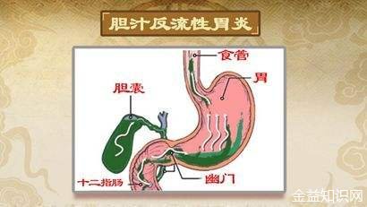 羊胆汁的功效与作用