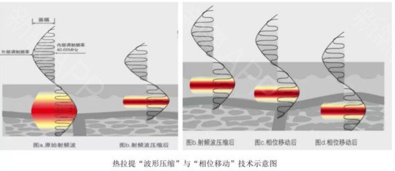 热拉提的功效与作用