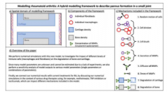 新的建模技术预测类风湿性关节炎将如何影响小关节