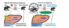 怀孕期间的运动可降低后代患2型糖尿病的风险